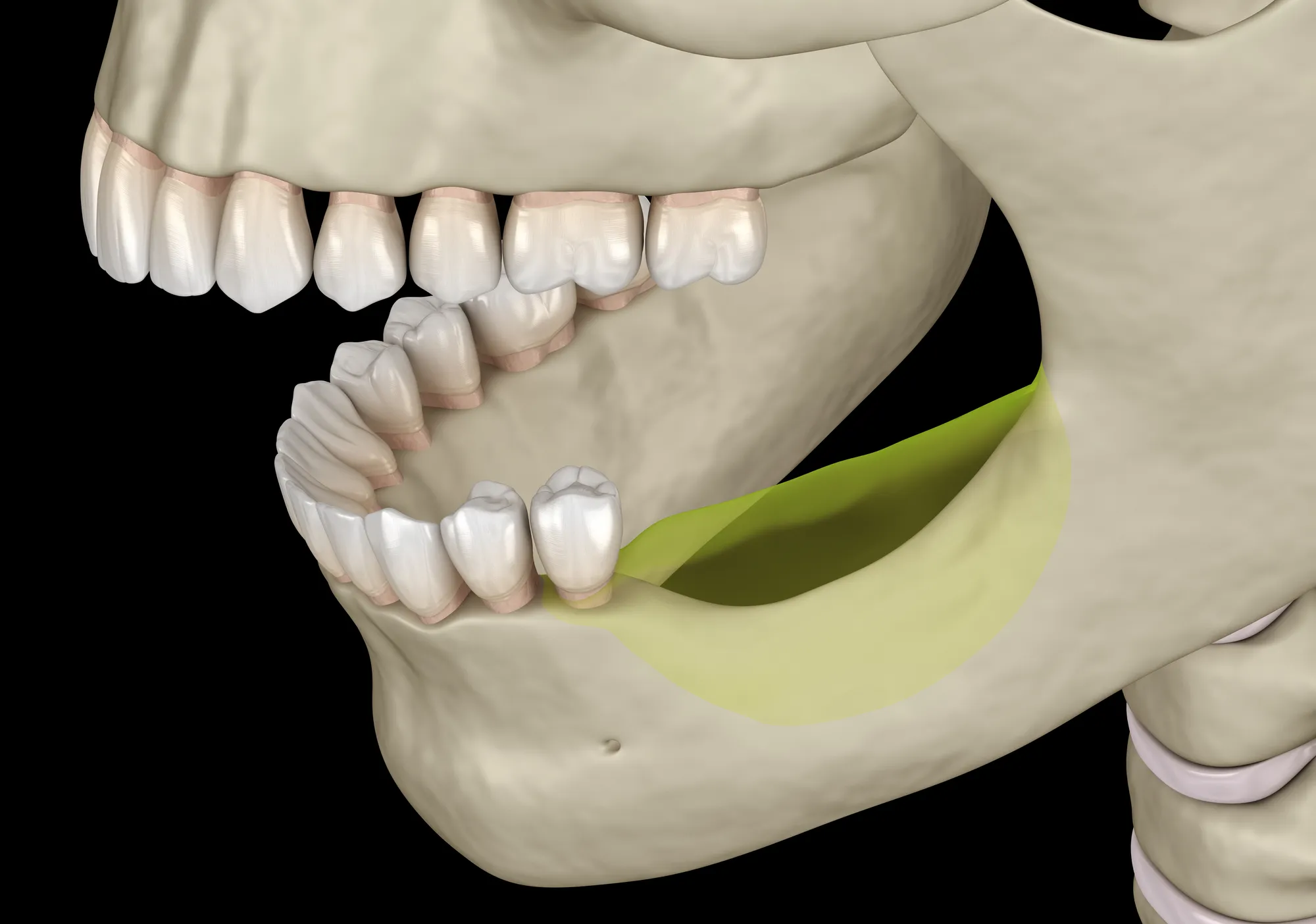 shutterstock_1555107761 Chirurgia Estrattiva